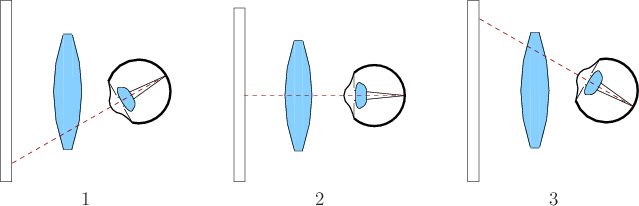 \begin{figure}\begin{center}
\begin{tabular}{ccccc}
\psfig{file=figs/eye13.eps,w...
...ps,width=1.5truein} \\
1 & & 2 & & 3 \\
\end{tabular}\end{center}
\end{figure}