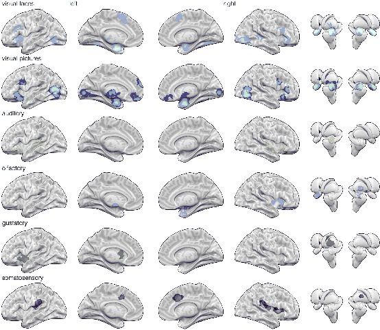 \begin{figure}\centerline{\psfig{file=figs/fmri2.ps,width=\columnwidth}}\end{figure}