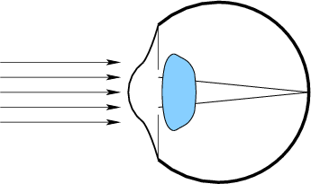 \begin{figure}\centerline{\psfig{file=figs/eye3.eps,width=3.0truein}}\end{figure}