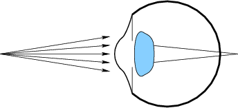 \begin{figure}\centerline{\psfig{file=figs/eye4.eps,width=3.0truein}}\end{figure}