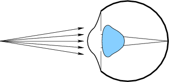 \begin{figure}\centerline{\psfig{file=figs/eye5.eps,width=3.0truein}}\end{figure}