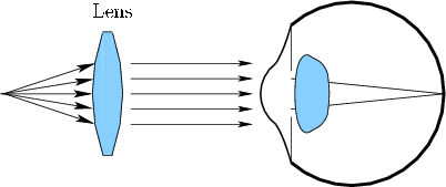 \begin{figure}\centerline{\psfig{file=figs/eye6.eps,width=3.5truein}}\end{figure}